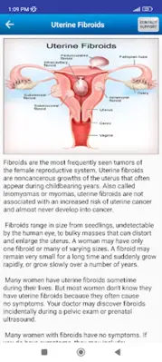 Diet & Help for Uterine Fibroids android App screenshot 12