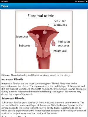 Diet & Help for Uterine Fibroids android App screenshot 5