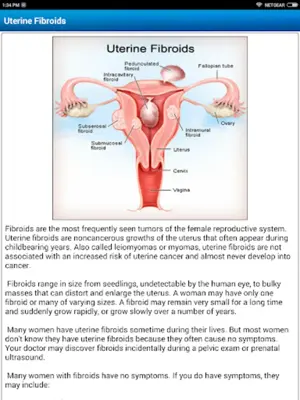 Diet & Help for Uterine Fibroids android App screenshot 7